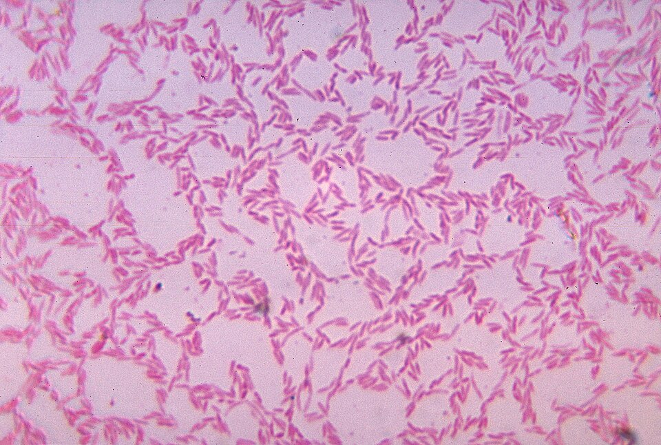 Anaerobic Chamber