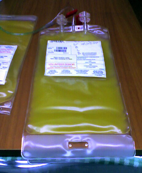 Apheresis Machine