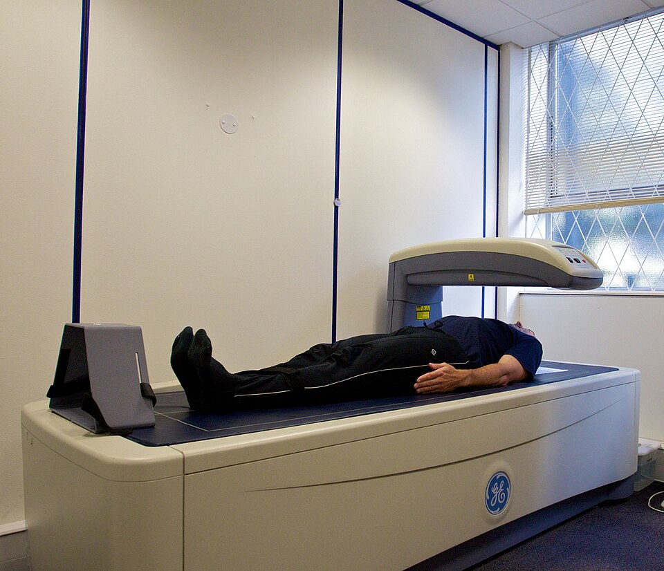 Bone Densitometer (DXA)