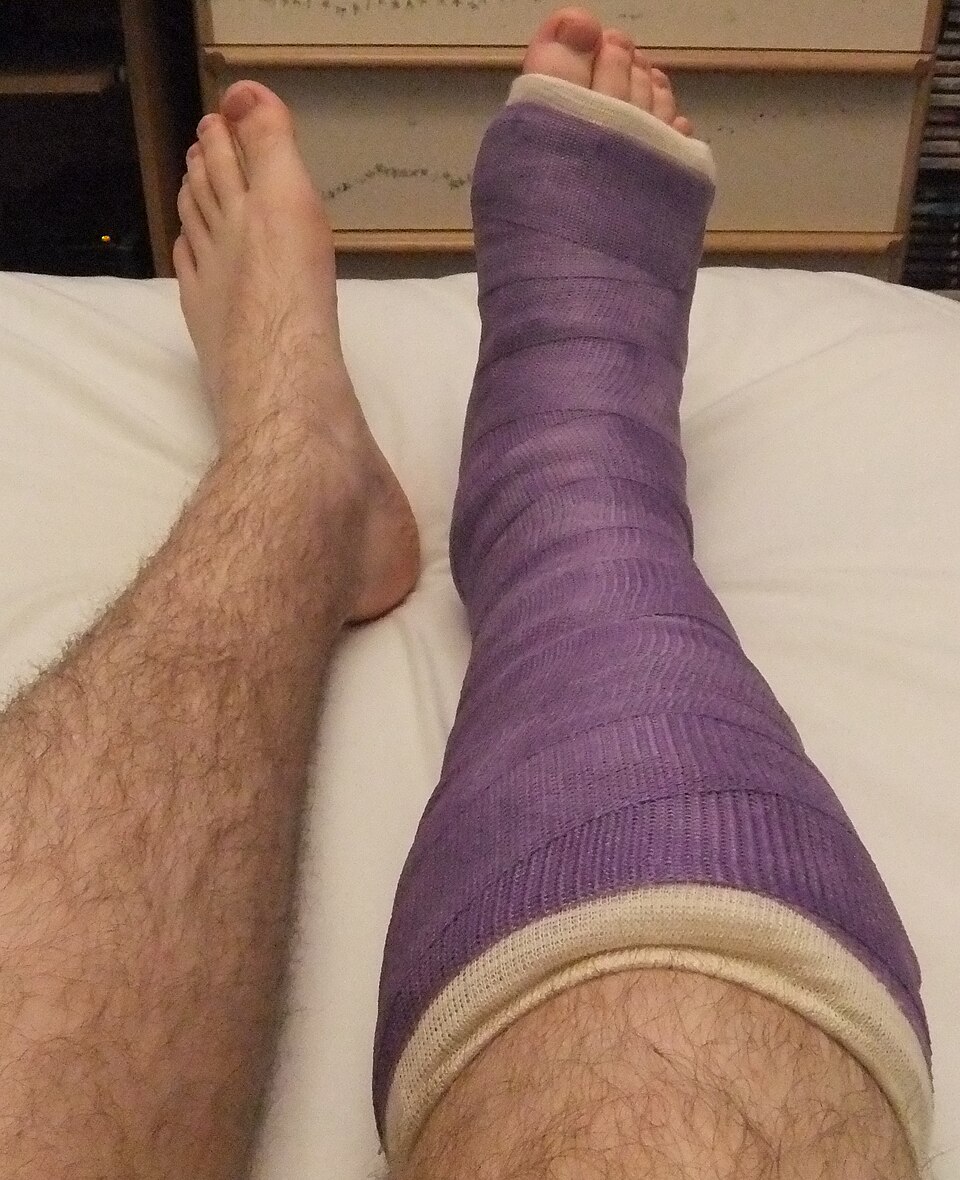 Orthopedic Cast Saw