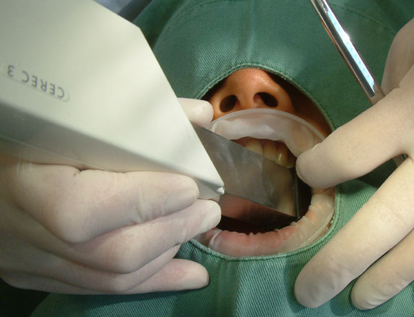 Intraoral Camera