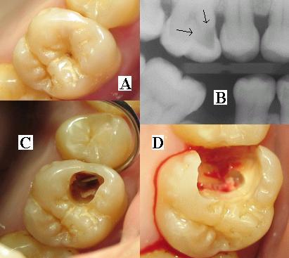 Dental X-Ray Unit