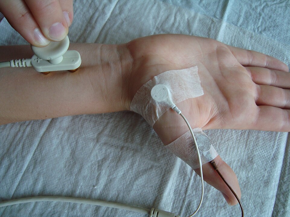 EMG/NCS Machine