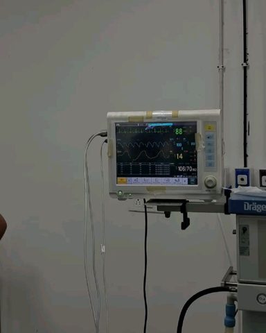 ECG MACHINE.jpg