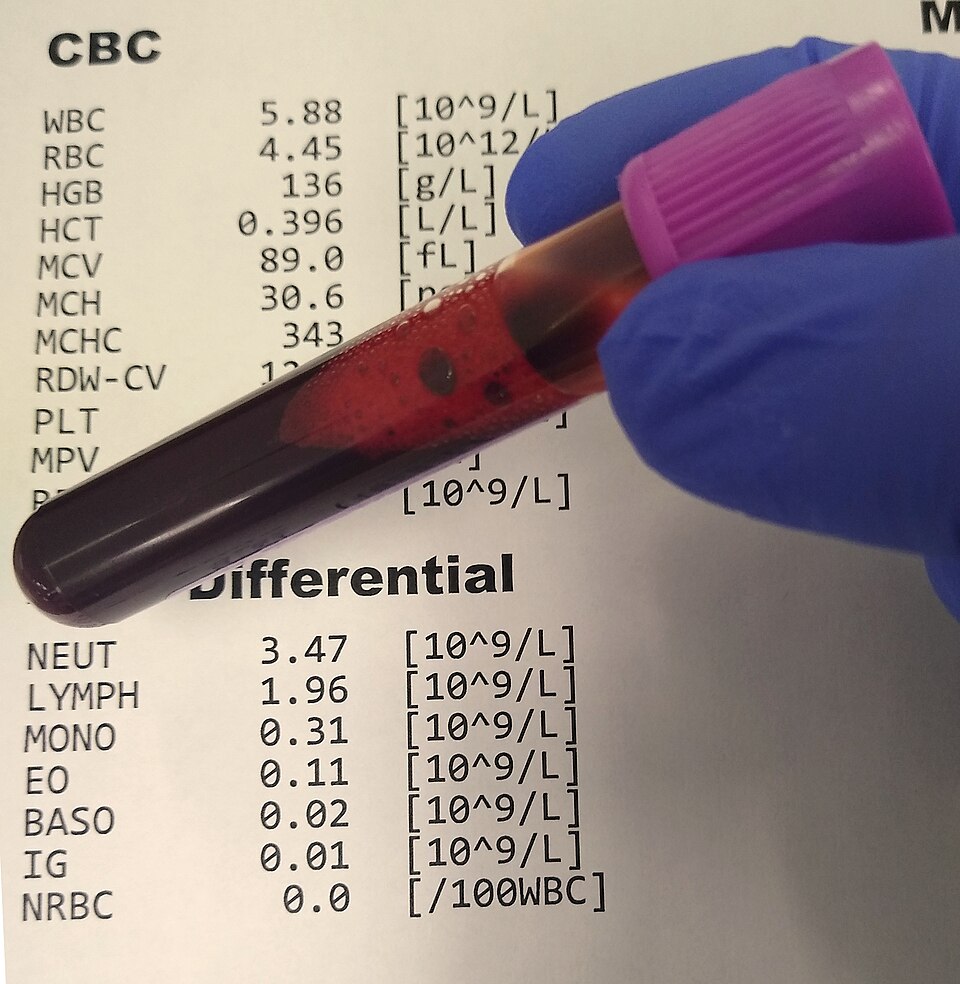 Hematology Analyzer