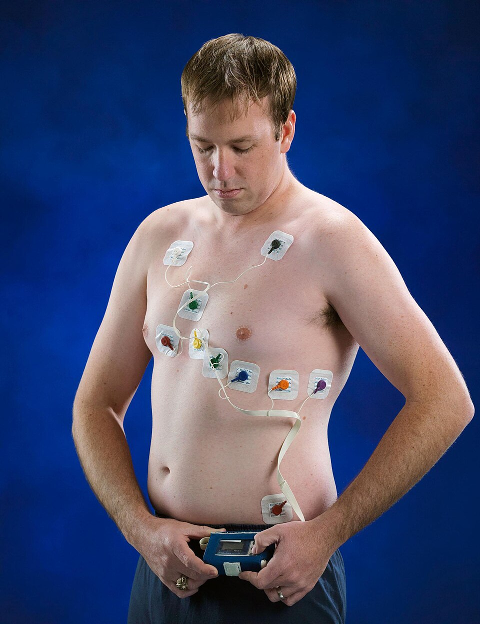 Holter ECG Monitor