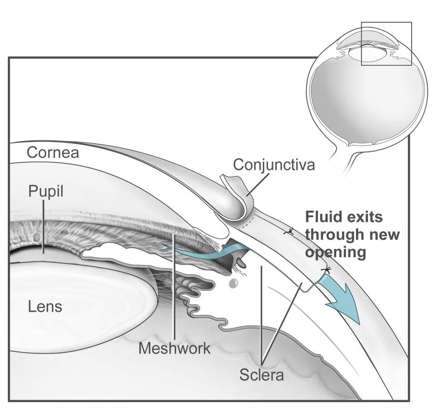 Ophthalmic YAG/SLT Laser