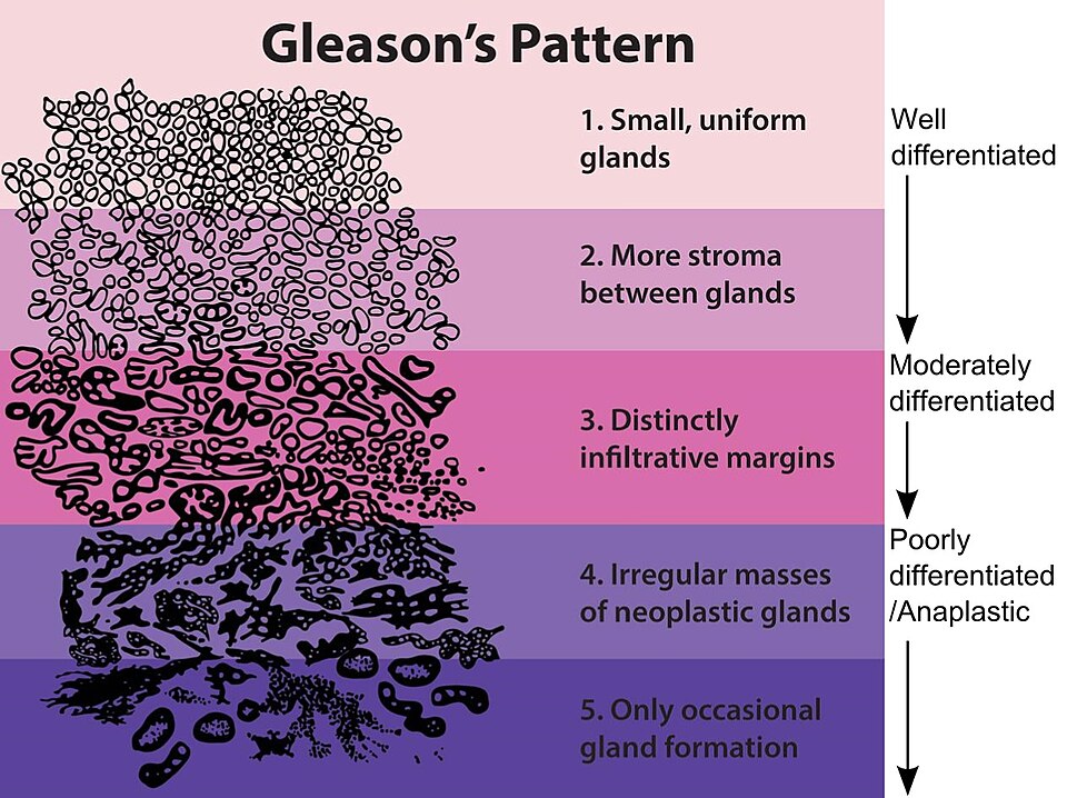 Pattern Grading System