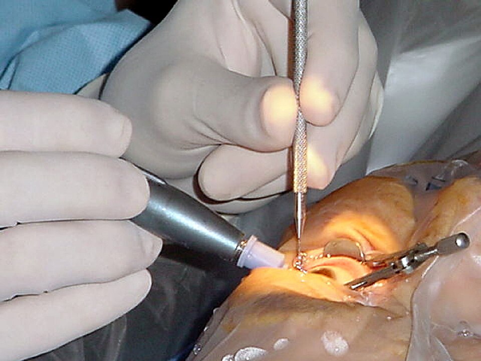 Phacoemulsification System