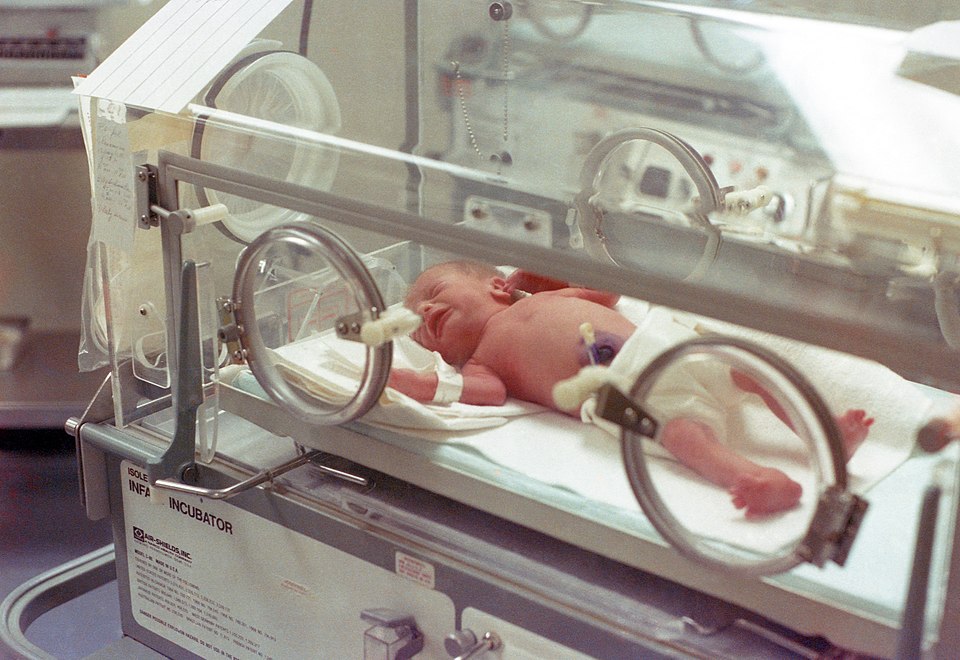 Neonatal Phototherapy Unit