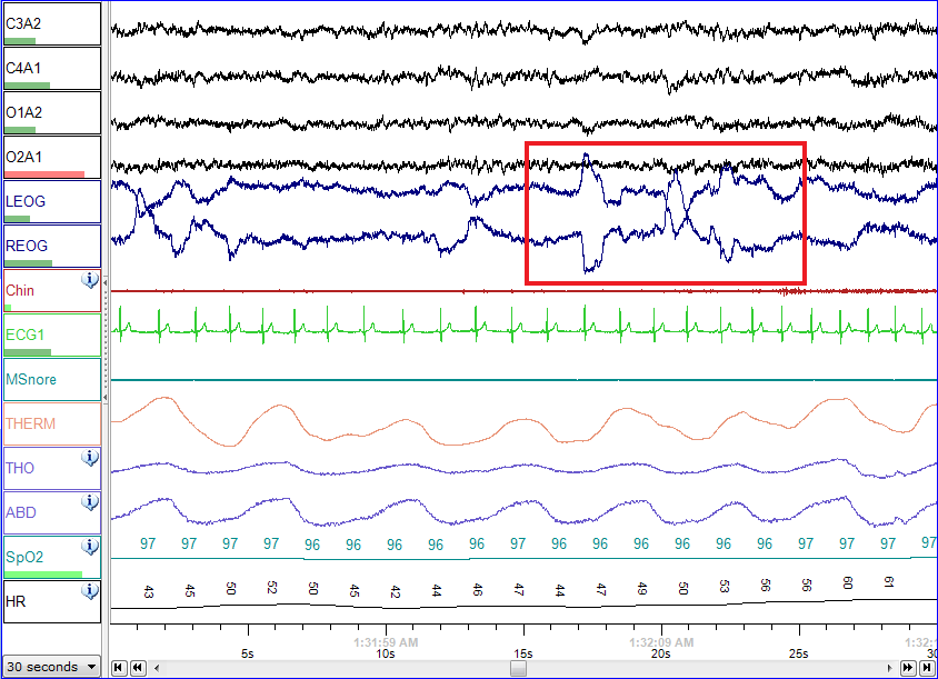 Polysomnography System