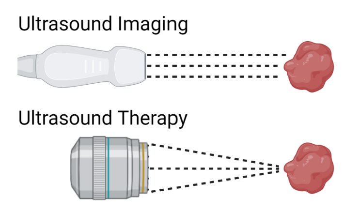 Therapeutic Ultrasound