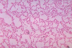 Anaerobic Chamber