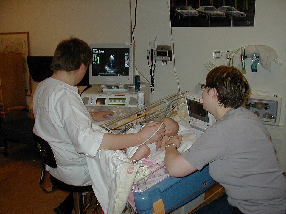 Ultrasound Machine
