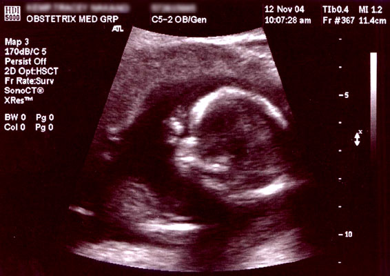 Veterinary Ultrasound