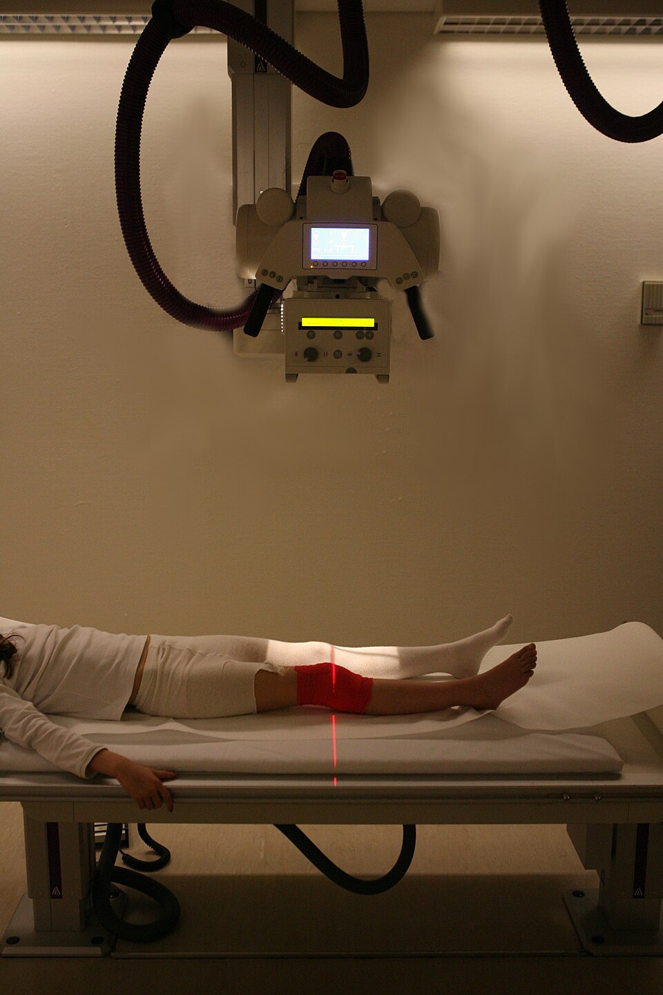 X-Ray Machine